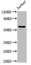 Polyclonal Rabbit anti-Human CDw218a / IL18R1 Antibody (IHC, WB)