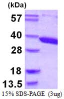 Human ACY3 Protein (Recombinant His)
