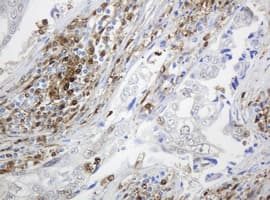 TP / Thymidine Phosphorylase Antibody (aa311-482, clone OTI1E7, Carrier-free)