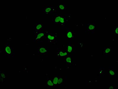 HIST1H1E Antibody