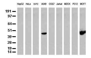 KRT19 / CK19 / Cytokeratin 19 Antibody (aa240-390, clone UMAB2)