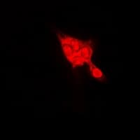 Selenium Binding Protein 1 Antibody