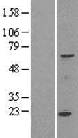 SPATA16 / NYD-SP12 Protein (Over-Expression Lysate Myc-DDK (Flag))