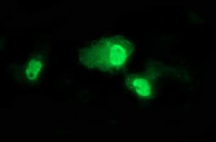 TP73 / p73 Antibody (aa167-409, clone OTI2D2)