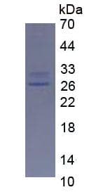 Human IL17A Protein (Recombinant)