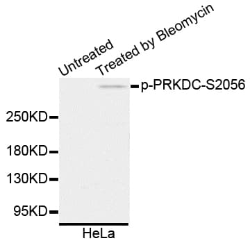 PRKDC / DNA-PKcs Antibody (phospho-Ser2056)