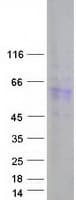 Human DAZ4 Protein (Recombinant Myc-DDK (Flag))
