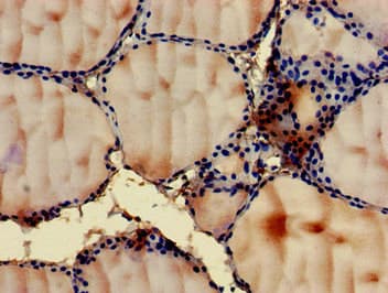 GIT1 Antibody