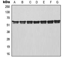 Polyclonal Rabbit anti-Human TRAF3 Antibody (Internal, IF, WB)
