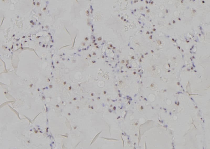 Polyclonal Rabbit anti-Human HIST3H3 Antibody (Methyl-Lys9, IHC, IF, WB)