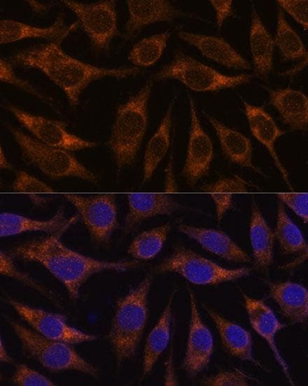 AGR2 Antibody
