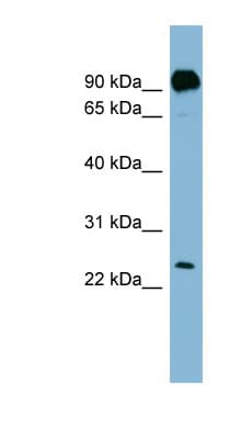 PRGP1 / PRRG1 Antibody (N-Terminus)