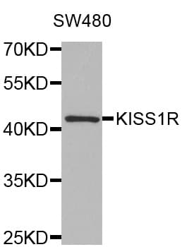 IHC-plus™ Polyclonal Rabbit anti-Human KISS1R / GPR54 Antibody (IHC, WB)
