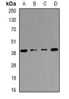 TMOD4 Antibody