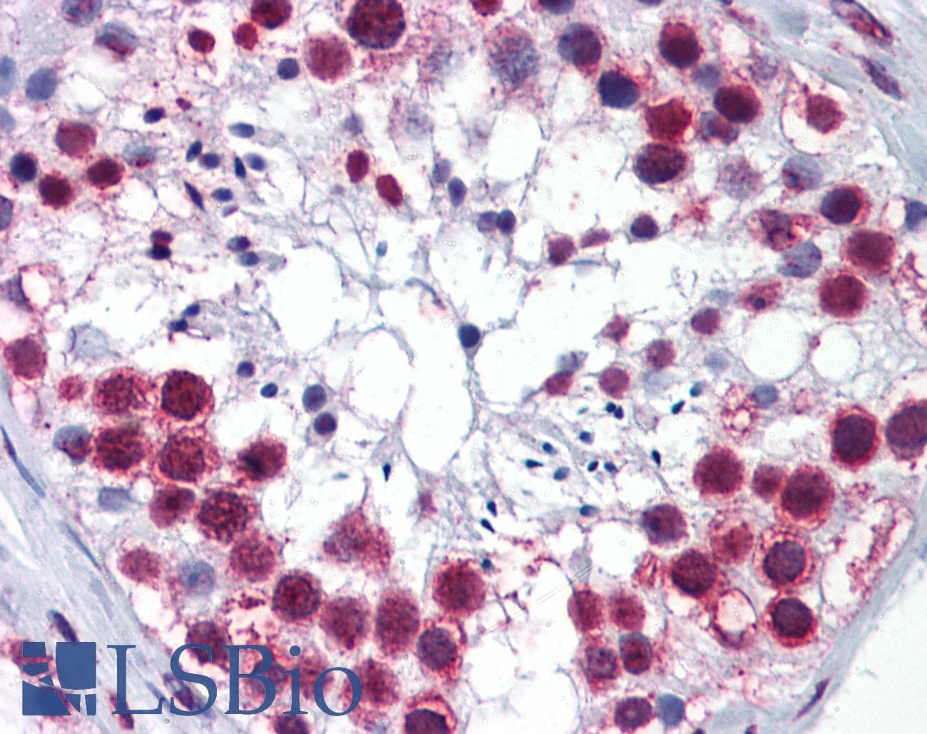 IHC-plus™ RSL24D1 Antibody (clone 2A10-1E5)