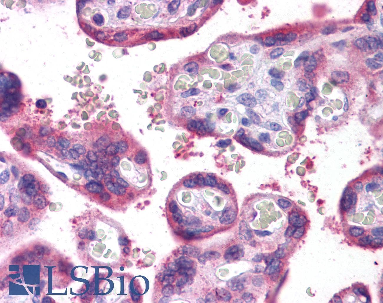 IHC-plus™ Polyclonal Rabbit anti-Human WDR92 Antibody (IHC, IF, WB)