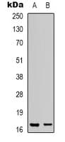 Polyclonal Rabbit anti-Human DAT1 / LMO3 Antibody (C-Terminus, IHC, WB)