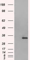 AURKC / Aurora C Antibody (clone OTI2B7)