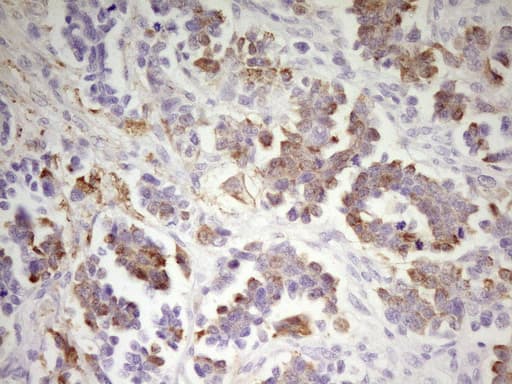 Monoclonal Mouse anti-Human MED15 / ARC105 Antibody (clone OTI1H5, aa393-679, IHC, WB)