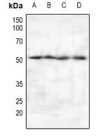 PIPOX / Sarcosine Oxidase Antibody