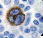 EBV LMP Antibody (clone CS1-4, Ready-to-Use)