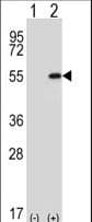 Polyclonal Rabbit anti-Human DDX39 Antibody (aa250-277, WB)