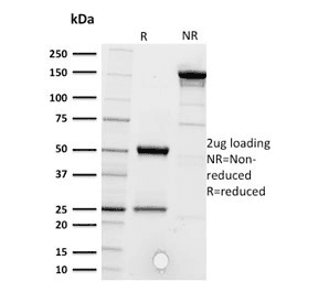 CD5 Antibody (clone CD5/2416)