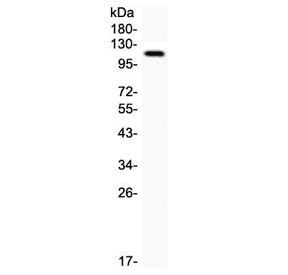 HAVCR1 / KIM-1 Antibody