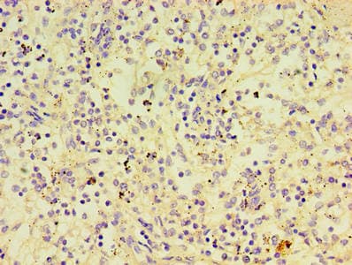 PTPN5 / STEP Antibody (aa300-555)