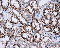PIM2 / Pim-2 Antibody (clone OTI5B5)