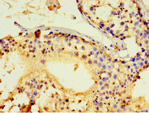 ACRV1/Intra-Acrosomal Protein Antibody (aa22-265)