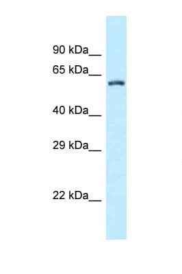 ZC3H12A / MCPIP1 Antibody (aa320-369)