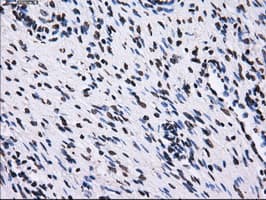 RPA2 / RFA2 / RPA34 Antibody (clone OTI7C12)