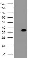 BCL10 / BCL-10 Antibody (clone OTI3C2)
