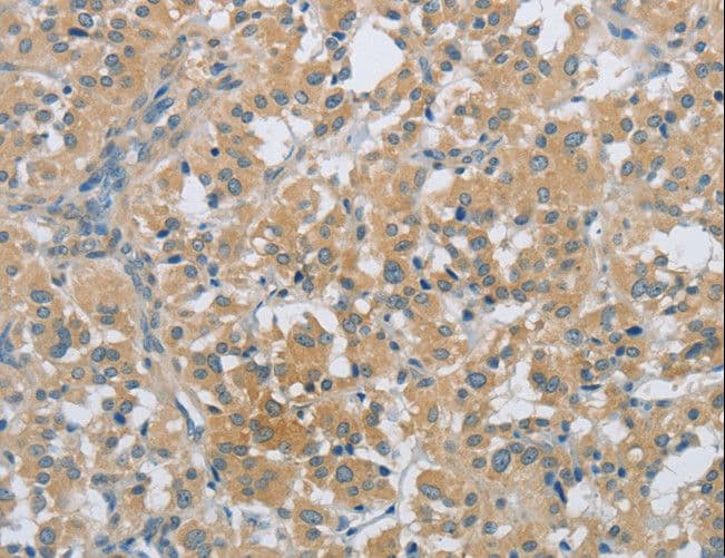 PKD1 / Polycystin Antibody (aa3725-3735)