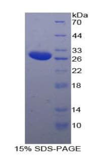 Rat IL2RB / CD122 Protein (Recombinant His)