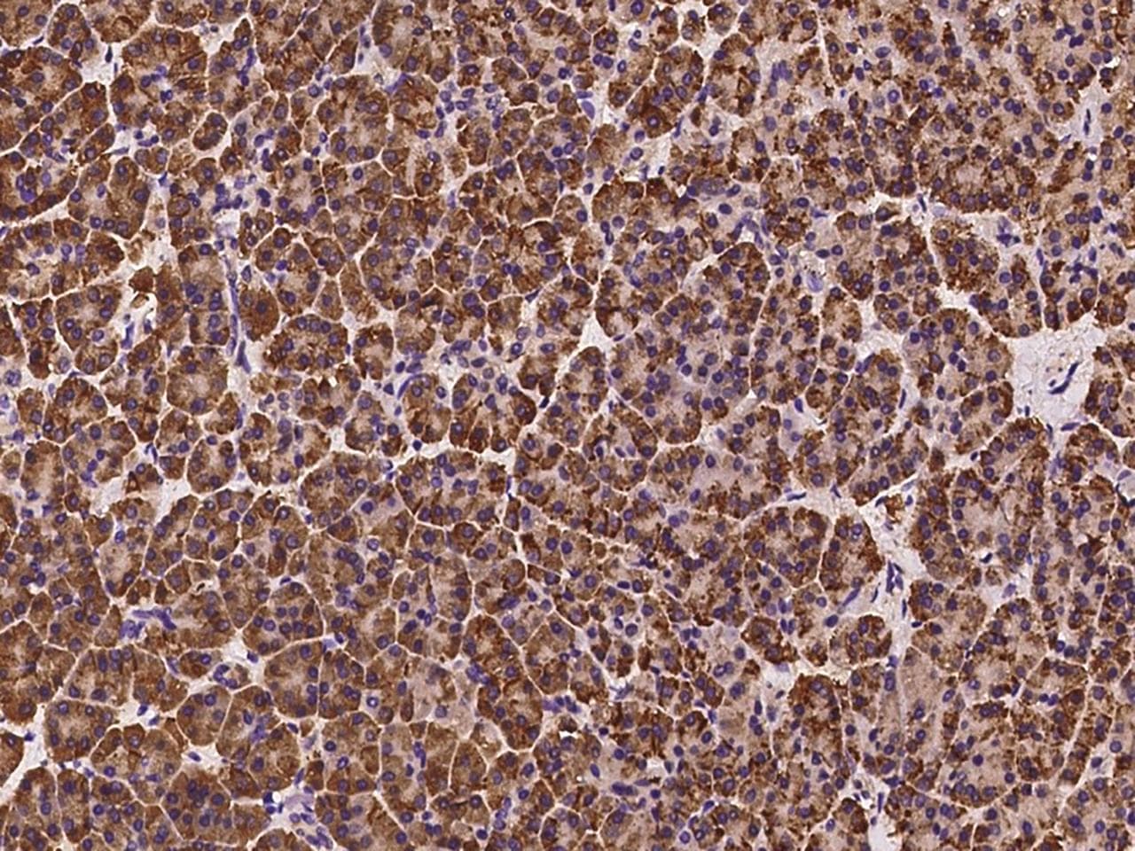 SPINK1 Antibody