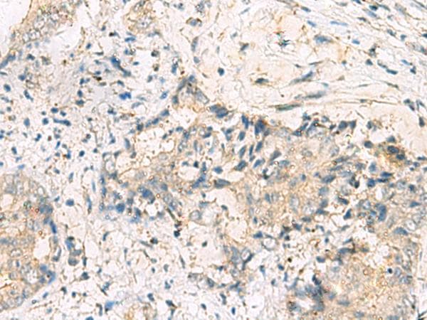 Polyclonal Rabbit anti-Human MGAT4B Antibody (IHC)