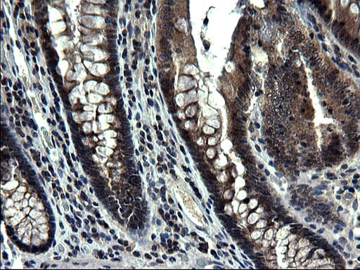 ZFAND3 / TEX27 Antibody (clone OTI1G7)