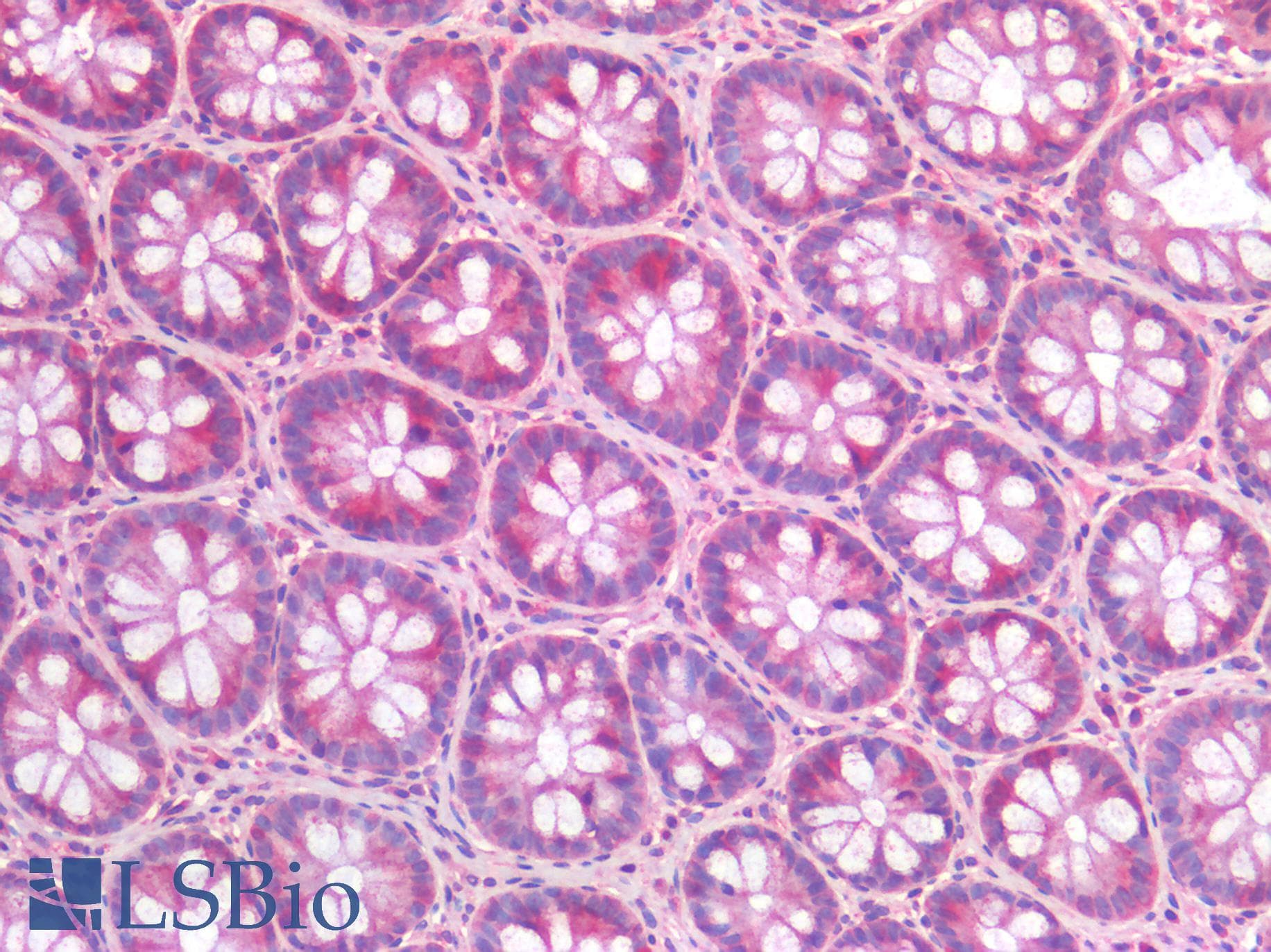 IHC-plus™ ALK2 / ACVR1 Antibody