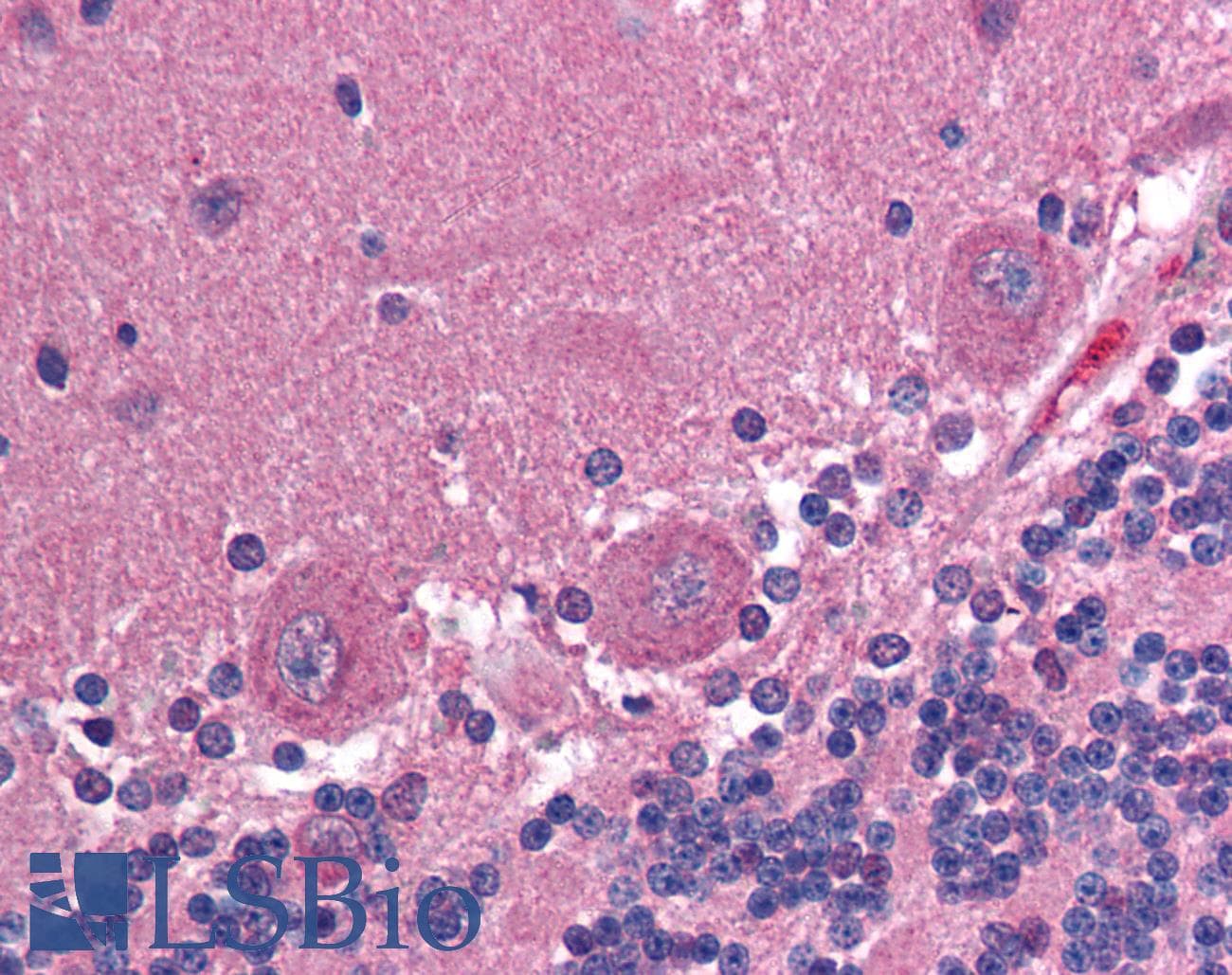 IHC-plus™ Monoclonal Mouse anti-Human CCT2 / CCT Beta Antibody (clone F39 P7 F11, IHC, WB)