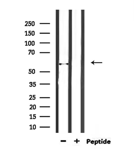 ENDOD1 Antibody
