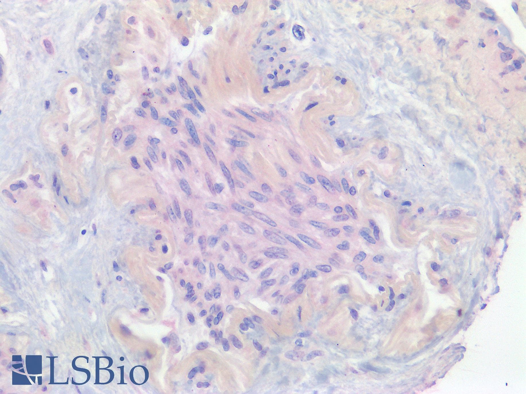 PathPlus™ ER Alpha / Estrogen Receptor Antibody