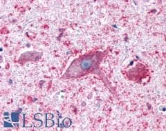 PathPlus™ PGR1 / GPR153 Antibody (Extracellular Domain)