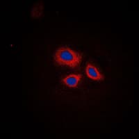 RNF144A / RNF144 Antibody (Internal)