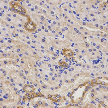 Polyclonal Rabbit anti-Human TNFRSF1B / TNFR2 Antibody (IHC, IF, WB)