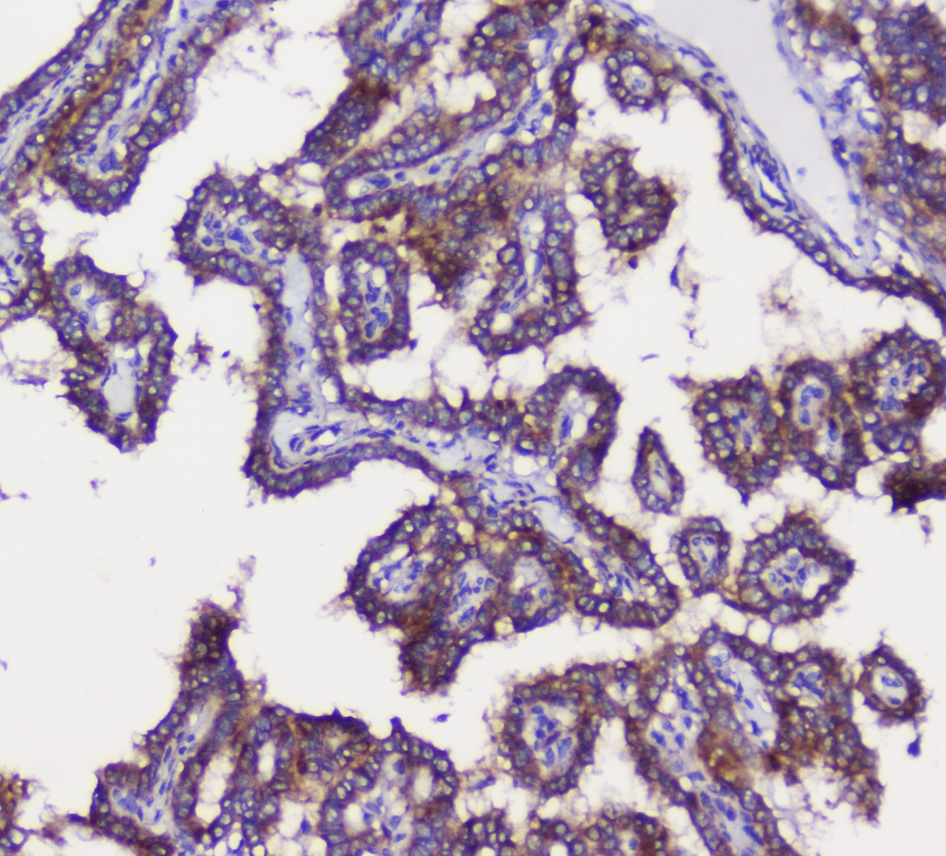 Polyclonal Rabbit anti-Human GRIK1 / GLUR5 Antibody (aa271-450, WB)