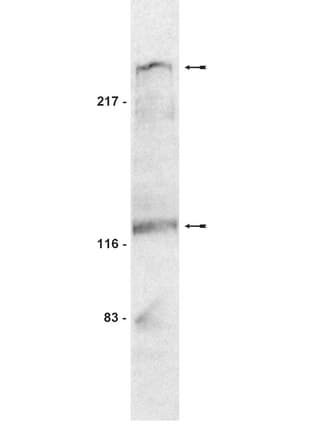IHC-plus™ NOTCH1 Antibody (aa2272-2488)