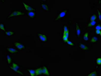 FAK / Focal Adhesion Kinase Antibody