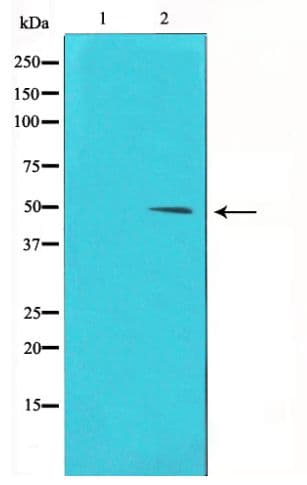 Polyclonal Rabbit anti-Human CCNE1 / Cyclin E1 Antibody (phospho-Thr395, IHC, WB)